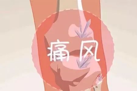 痛风的生活方式图_痛风的生活方式图_痛风的生活方式图