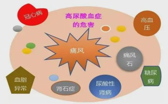 痛风的生活方式图_痛风的生活方式图_痛风的生活方式图